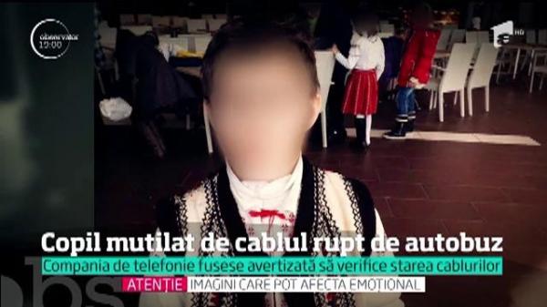 Un copil a fost DESFIGURAT, într-o intersecţie din Iaşi, de un cablu de telefonie smuls de un autobuz! Cine va da EXPLICAŢII pentru ceea ce avea să fie o TRAGEDIE!