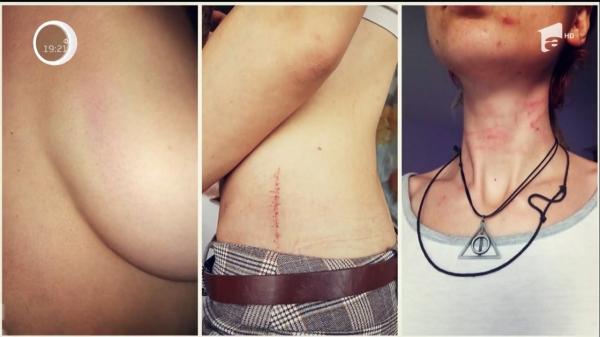 Detalii cutremurătoare din cazul cântăreţei bătute de soţ, un sunetist faimos. Iulia a căzut victimă violenţei chiar în luna de miere!