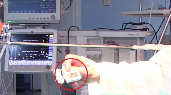 La Timişoara nu se mai fac intervenţii chirurgicale din cauza caniculei!