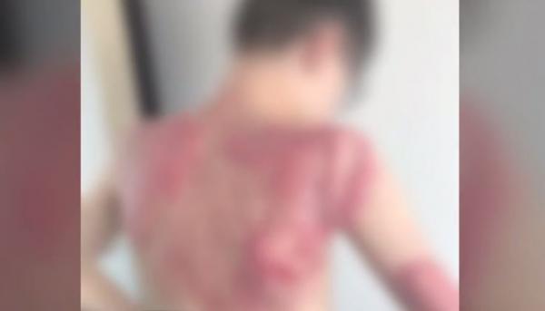 Un băieţel de 12 ani a suferit arsuri grave, în timp ce kartul în care se afla a fost cuprins de flăcări