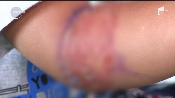 Acuzaţii grave la spitalul din Slatina. Băieţelul unei familii aflate în vacanţă în România, mutilat de o branulă