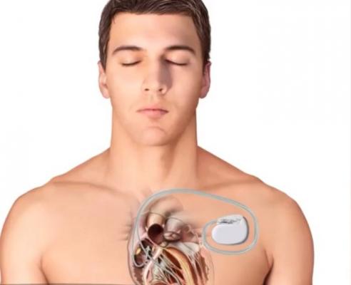 Hackerii pot provoca și un atac de cord, nu doar atacuri cibernetice