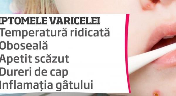 Pericol de epidemie de varicelă. Vaccinul a dispărut din farmacii