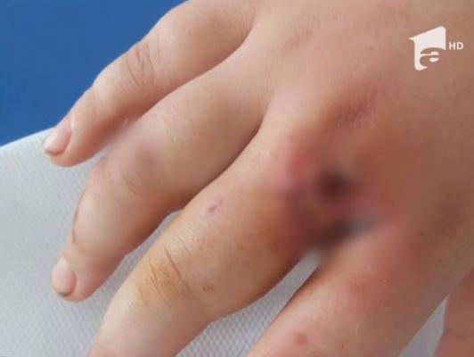 Maidanezii fac victime în Constanţa! Un copil a fost muşcat chiar în faţa blocului în care locuieşte