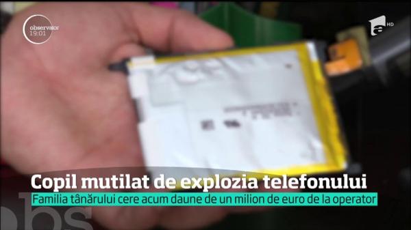 Copil mutilat de explozia telefonului din buzunar. Clipele de groază povestite de mama sa: 'Ieşea fum din blugi'