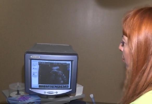 Nașteri programate, pentru ca bebelușul să fie într-o zodie dorită de părinți. Ce spun astrologii