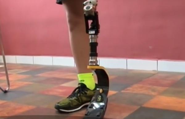 Model de ambiție și curaj: La 13 ani, fără un picior, Arian practică înotul de performanţă, aleargă şi merge cu bicicleta