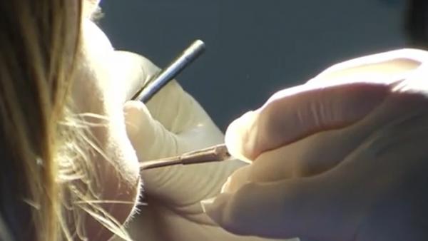 Noi acuzații împotriva medicului stomatolog din Bucuresti, care ar fi prea bolnav ca să profeseze