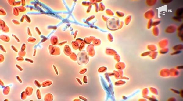 O nouă infecţie periculoasă a ajuns în Statele Unite. Aproape jumătate din pacienţii infectaţi mor în 90 de zile