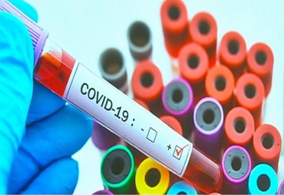 Pandemia de coronavirus continuă să afecteze grav numeroase state din întreaga lume (Video)