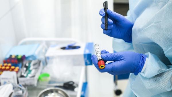 28 de cazuri confirmate de îmbolnăvire cu coronavirus în Strehaia