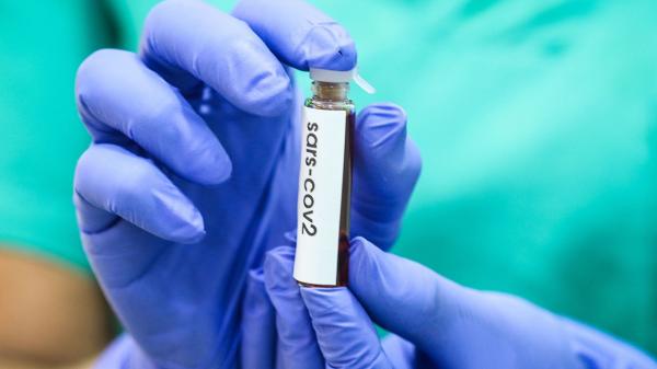 Laboratoarele pentru testele de covid sunt suprasolicitate. 7 zile de așteptare pentru prelucrarea datelor