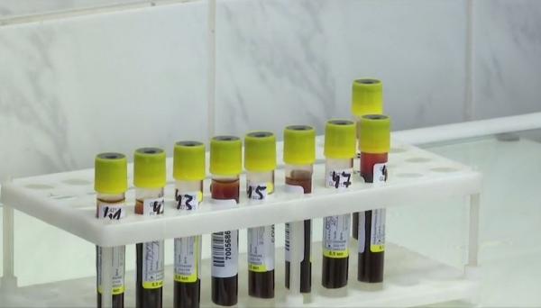 Rusia grăbește aprobarea primului vaccin pentru coronavirus. Experții occidentali atrag atenția asupra efectelor grave