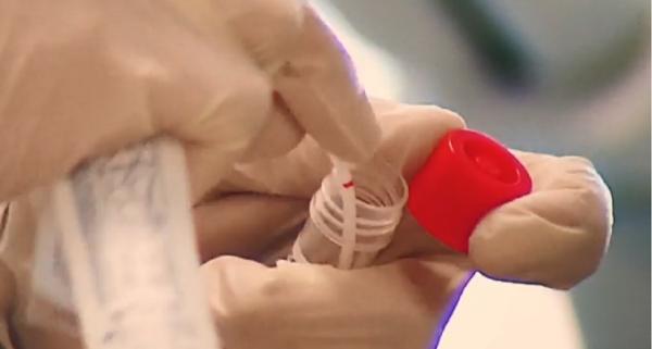 O parte dintre pacienții infectați cu noul coronavirus se pot reinfecta, conform specialiștilor