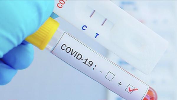 Noile tulpini de Covid pot păcăli testele. Specialiştii internaţionali recomandă o analiză mai complexă