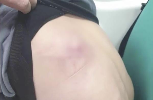 O copilă de 14 ani a ajuns la spital, după ce a fost bătută de tatăl ei. Fata din Neamţ a fugit la o vecină ca să sune la 112