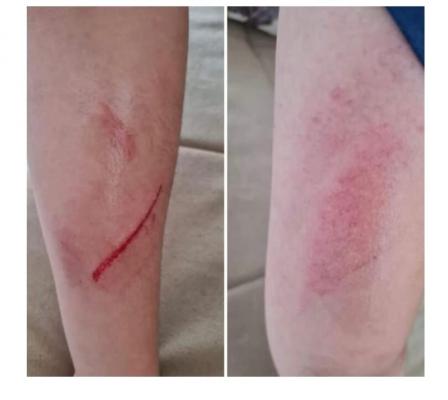Băiat, umilit şi rănit de colegi într-o şcoală din Târgu Jiu. Profesorii au aflat de incident de pe Facebook