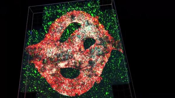 Tumoare canceroasă activă, reprodusă la imprimanta 3D. Experimentul a fost realizat la universitatea din Tel Aviv