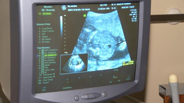 Simptomele malformaţiei congenitale la nou-născuţi. Cum ne dăm seama că bebeluşul are o afecţiune cardiacă