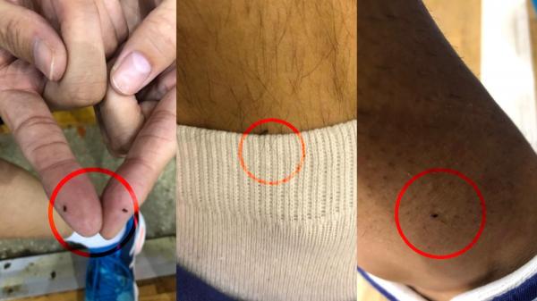 Antrenamente cu purici la Sala Sporturilor din Piteşti. Sătui să ajungă acasă plini de ciupituri, sportivii protestează. "Sună amuzant, dar este periculos"