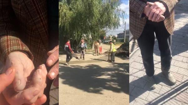 Bătrân rănit, după ce a căzut pe o stradă din Iaşi. Bărbatul ar fi călcat în betonul proaspăt turnat: "Muncitorii nu au pus banda şi dânsul s-a lovit"