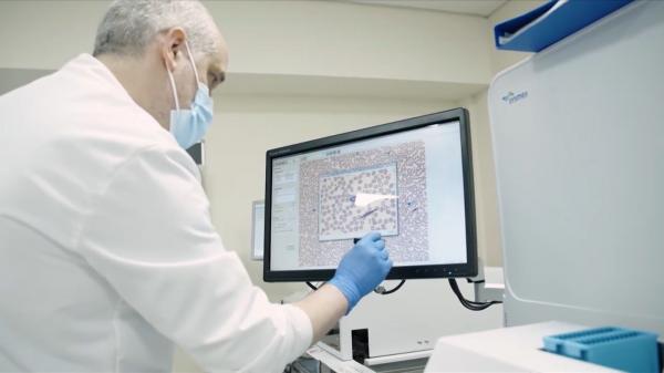 Ce sunt verucile și cum putem scăpa de ele