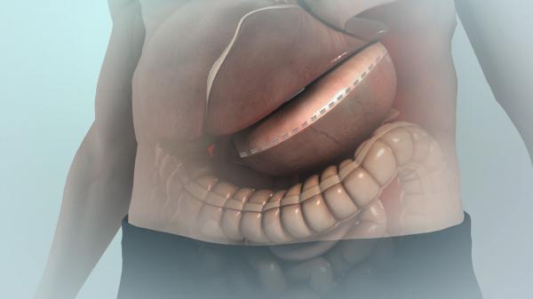 Animaţie grafică. Campionul de raliu Daniel Onoriu este la terapie intensivă după ce şi-a tăiat stomacul în Turcia: "S-a desprins o capsă"