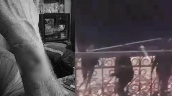 Plimbare cu sania, transformată în box. Un maramureşean a fost lovit de mai mulţi tineri, după ce le-a spus că i-au atins maşina