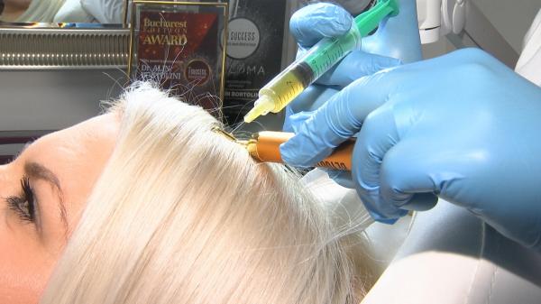 Tot ce trebuie să ştii despre Terapia Vampir. Cum stimulează tratamentul creşterea părului