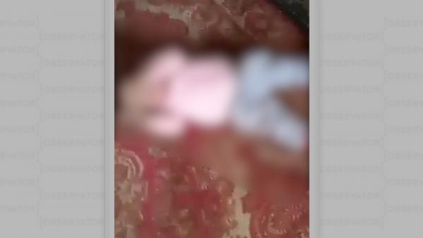 O fetiţă de un an şi jumătate din Bacău, lovită cu sălbăticie de propria mamă. Femeia se răzbuna astfel pe fostul soţ plecat la muncă în străinătate