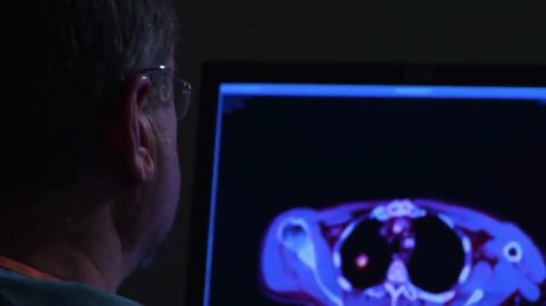 Tratament nou pentru cancer. Oamenii de ştiinţă americani au testat o substanţă pe 12 pacienţi, iar rezultatele sunt fără precedent