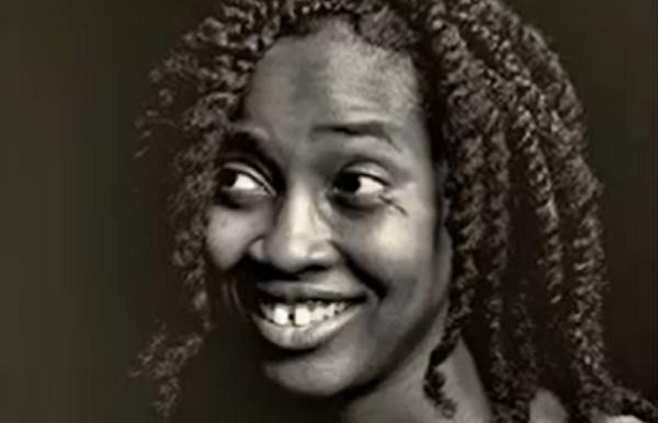 Povestea cicatricilor ''de aur''. Cum a ajuns o artistă din Marea Britanie să le schimbe vieţile oamenilor