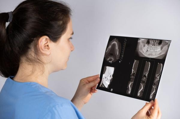 De unde mai vor autoritățile să mai strângă bani. Medicii stomatologi au intrat în vizorul ANAF