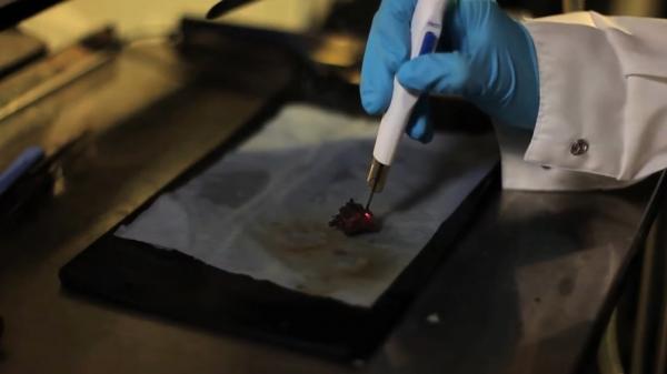 Descoperire revoluţionară a cercetătorilor britanici. Cancerul uterin, diagnosticat în câteva secunde