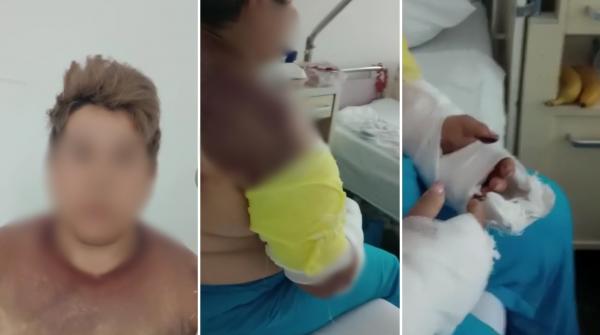 "De aici vie nu mai ieși, c***o!" Mărturia dramatică a femeii bătute cu toporul de șeful ei, în Șimian, după ce a vrut să demisioneze