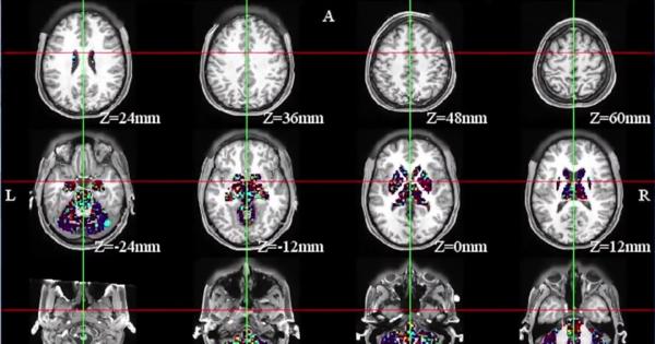 Bucharest Tech Week 2023. Terapia unică în Europa ce poate oferi soluţii chiar şi în cazul afecţiunilor pentru care nu există încă un tratament