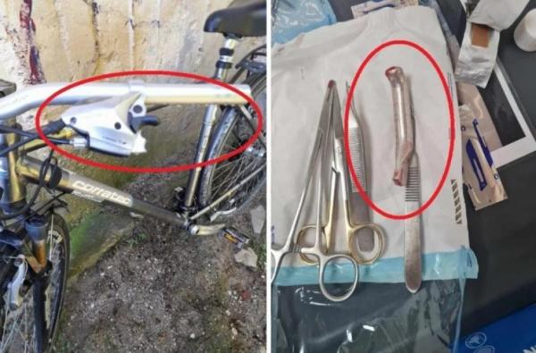 Mâner de frână de la bicicletă, cusut în piciorul unui pacient la Spitalul Urlaţi. Bărbatul a ajuns pe mâinile medicilor din Olanda: "M-a tăiat, a scos un fier de 8 cm"