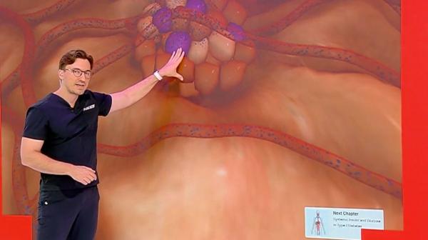 Care sunt primele simptome ale diabetului. Unul din zece oameni suferă de această boală