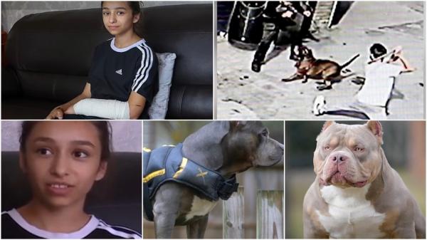 "A trecut pe lângă moarte". Drama Anei, o româncă de 11 ani, care a scăpat ca prin minune după ce a fost atacată de un câine în UK. Premierul ar putea interzice rasa