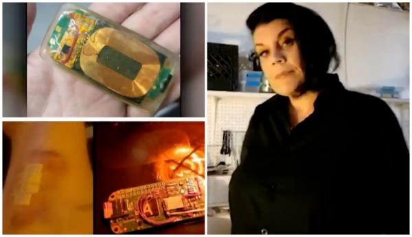 Femeia "robot" cu 52 de implanturi de metal. Ce poate face acum Anastasia