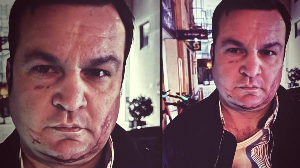 Cătălin Cherecheș nu vrea să se întoarcă în România. Cât ar putea dura extrădarea fostului primar