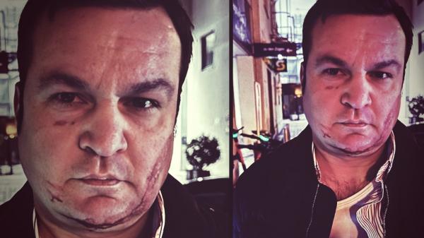 Poliţia germană explică de ce Cherecheş avea sânge pe faţă în poza făcută după arestare