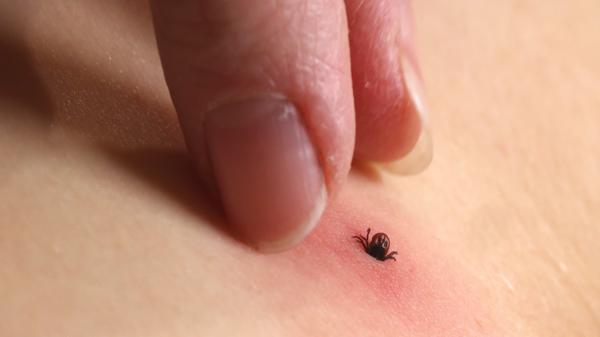 Ce trebuie să faceţi dacă vă treziţi cu o căpuşă pe piele. Nu trebuie să o scoateţi forţat