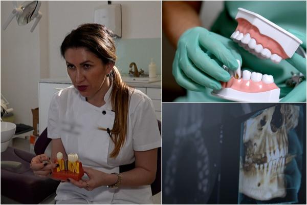 Un stomatolog spune care sunt problemele cauzate de un dinte lipsă. Când se recomandă să facem un implant dentar