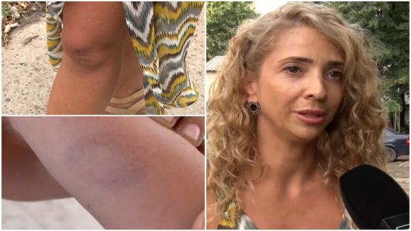 Varianta femeii care ar fi muşcat un copil pe plajă: i-a stricat machiajul, după ce a udat-o cu pistolul cu "jet puternic"
