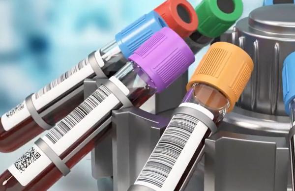 "Gwada negativ", grupa sanguină unică în lume descoperită la o femeie din Guadelupa