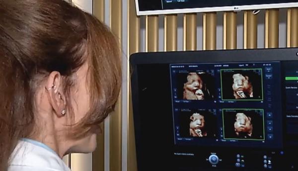 Când inteligenţa artificială îşi dă mâna cu medicina: Fotografii clare cu bebeluşii înainte să se nască