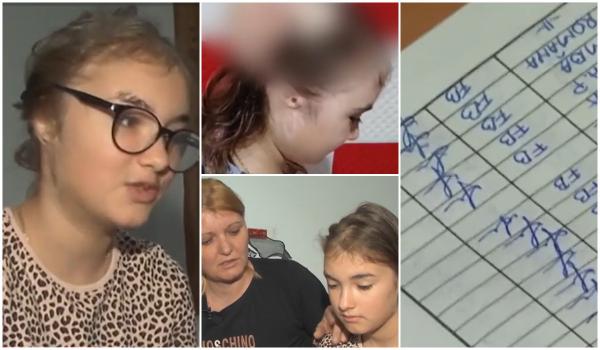 Povestea Andreei, fetiţa de 11 ani sfâşiată de maidanezi. A învins moartea şi acum visează la o viaţă normală