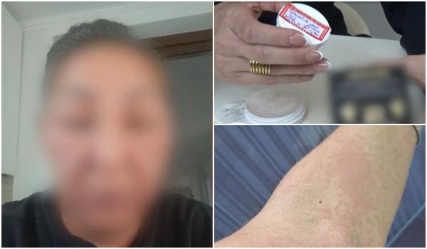 Crema cu mercur care a adus o femeie la un pas de moarte, vândută şi cu 500 de lei. "M-am trezit desfigurată"