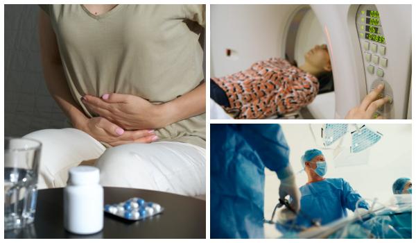 Endometrioza, afecțiunea greu de depistat care afectează fertilitatea. Primele semne ale bolii